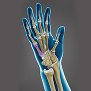 Hand Fracture Surgery